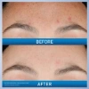 Picture of Cerave Resurfacing Retinol Serum