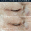 Picture of RoC Multi Correxion Hydrate Plump Eye Cream (17.7 ml)